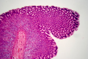 El estómago de Humana - microscópica: 